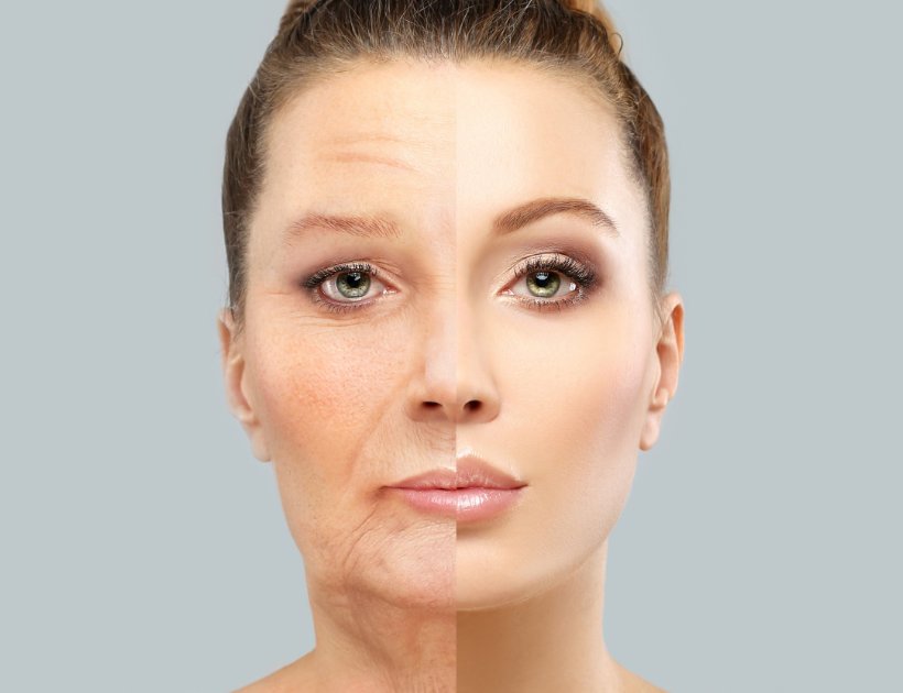 Vergleichendes Bild des Gesichts einer Frau, halb mit Falten und halb ohne