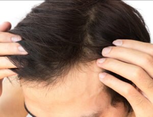 Nahaufnahme der Haare eines Mannes